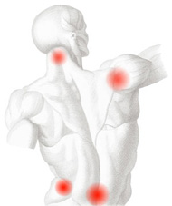 Inflammation Inflammation