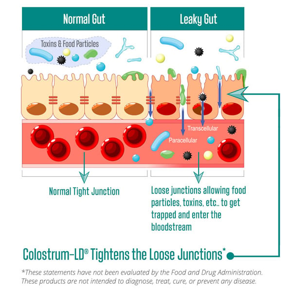 Normal Gut vs Leaky Gut Infographic