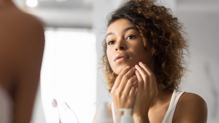 Hormonal Acne and Your Gut Health Hormonal Acne and Your Gut Health