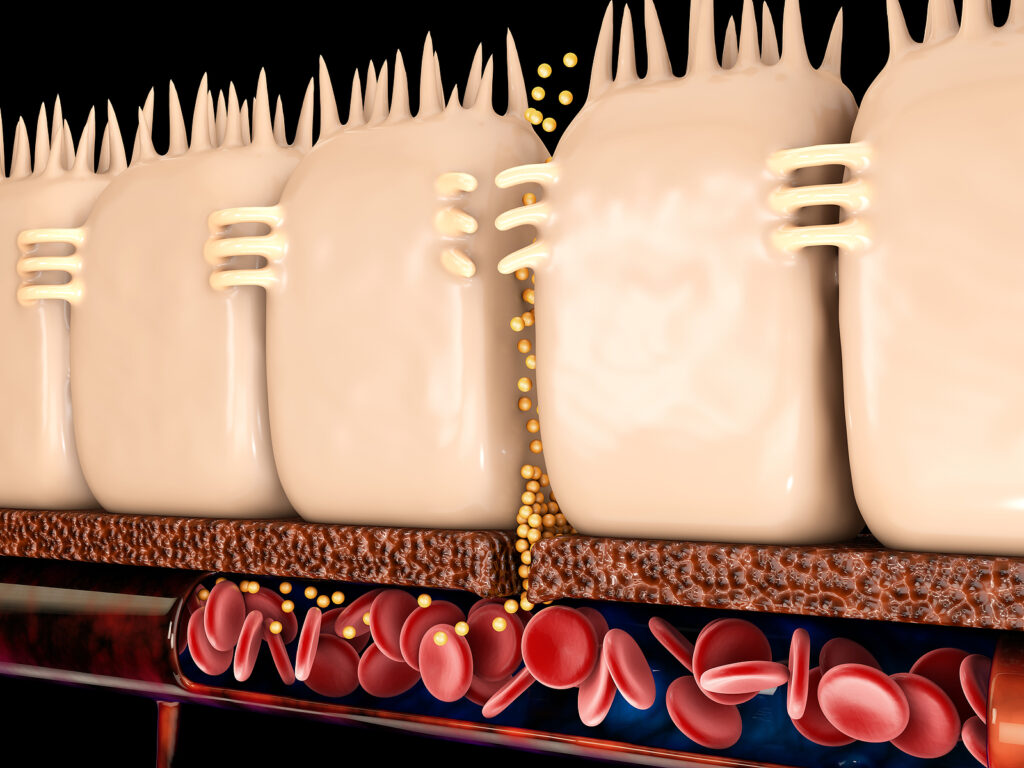 Representación 3d del intestino permeable, en el intestino donde se separan estas uniones estrechas.