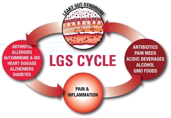 Leaky Gut Syndrome Cycle Leaky Gut Syndrome Cycle